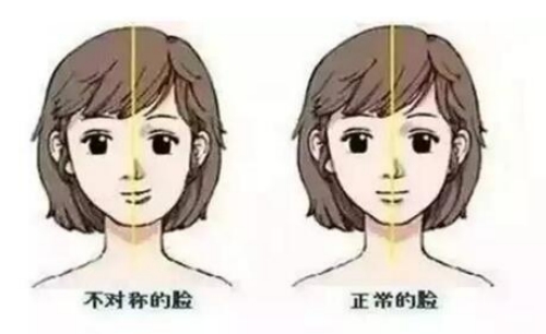 偏侧咀嚼有何危害 偏侧咀嚼如何处理