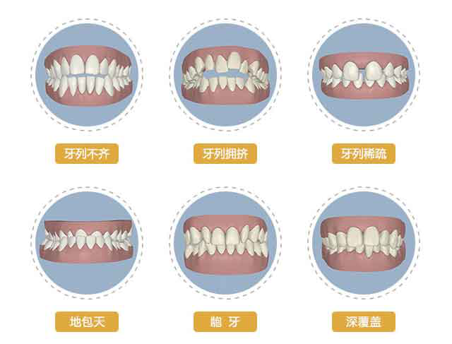 错颌畸形什么时候治疗效果最佳