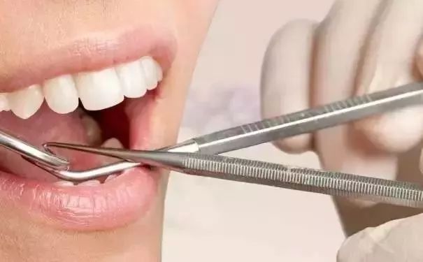 拔牙前后的注意事项