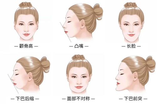 骨性错颌畸形矫治与成人正畸治疗