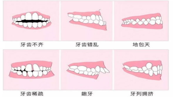 牙颌畸形会有哪些危害