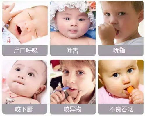 儿童牙齿为什么长得不整齐