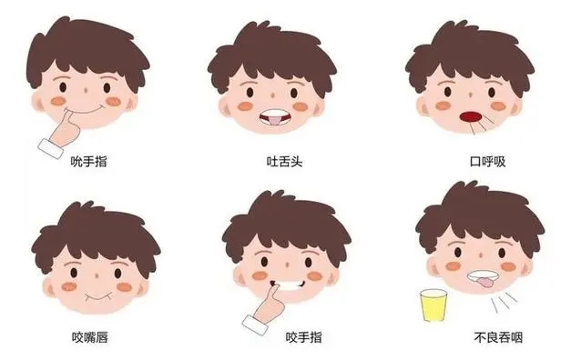 哪些不良习惯可造成牙颌畸形