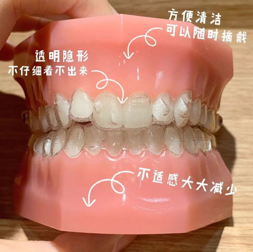 正畸小知识：在牙齿矫正时如何避免矫正方案不合理的情况？