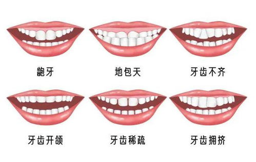 如何预防错颌畸形的发生？错颌畸形矫正需要注意什么？