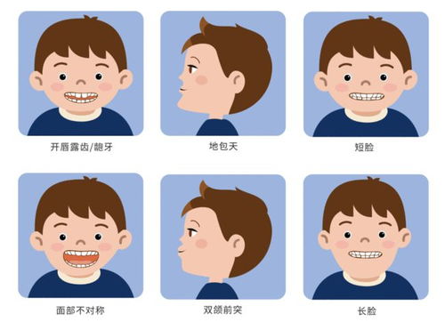 正畸小知识：儿童错颌畸形在什么时候矫正比较好？